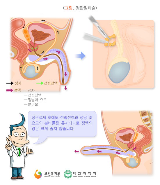 이미지명