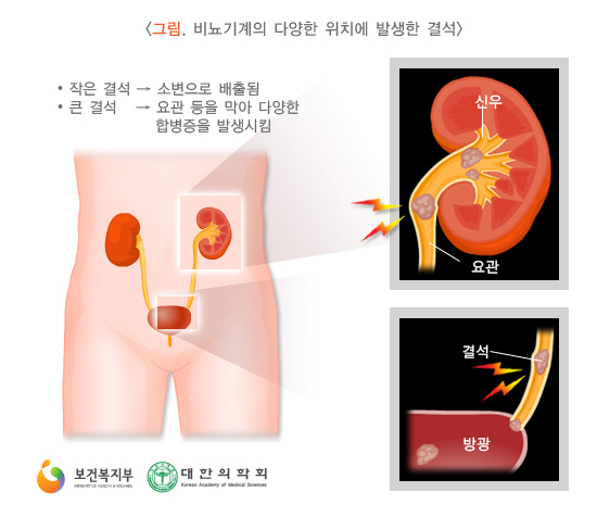 이미지명