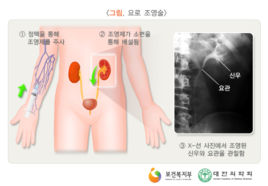 이미지명